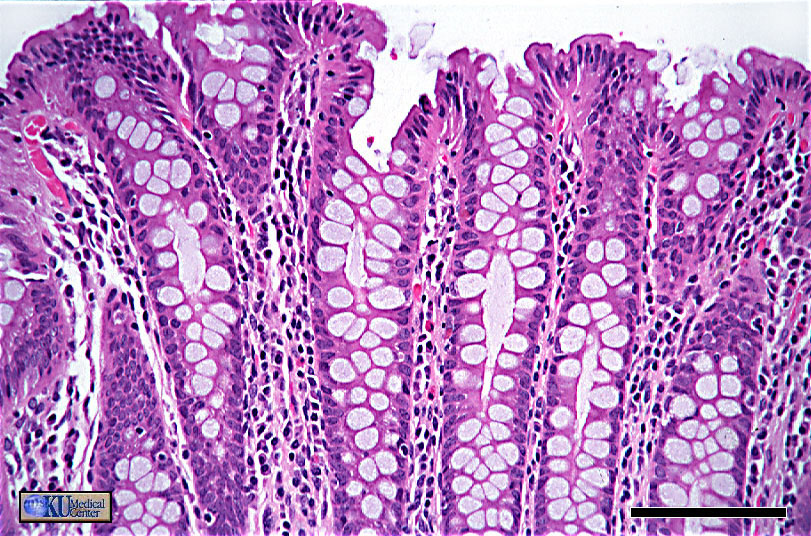 Gi Tract