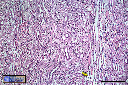 urinary ducts medulla
